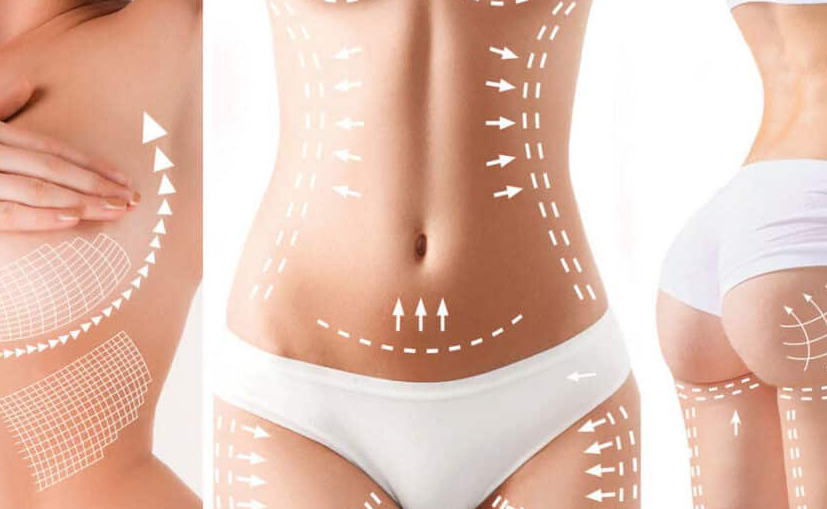 Jade-BodySculpt-Results