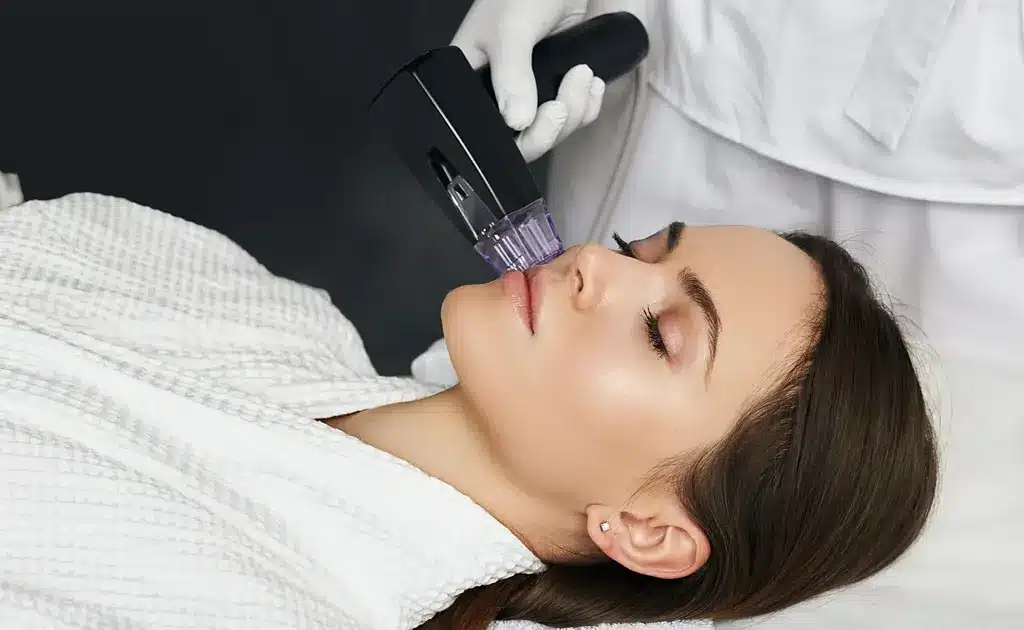 RF Microneedling