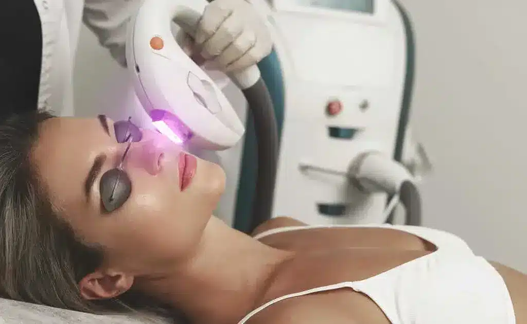 Top Benefits of Laser Hair Removal