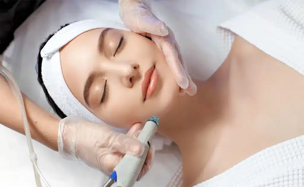 Laser Hair Removal Toronto